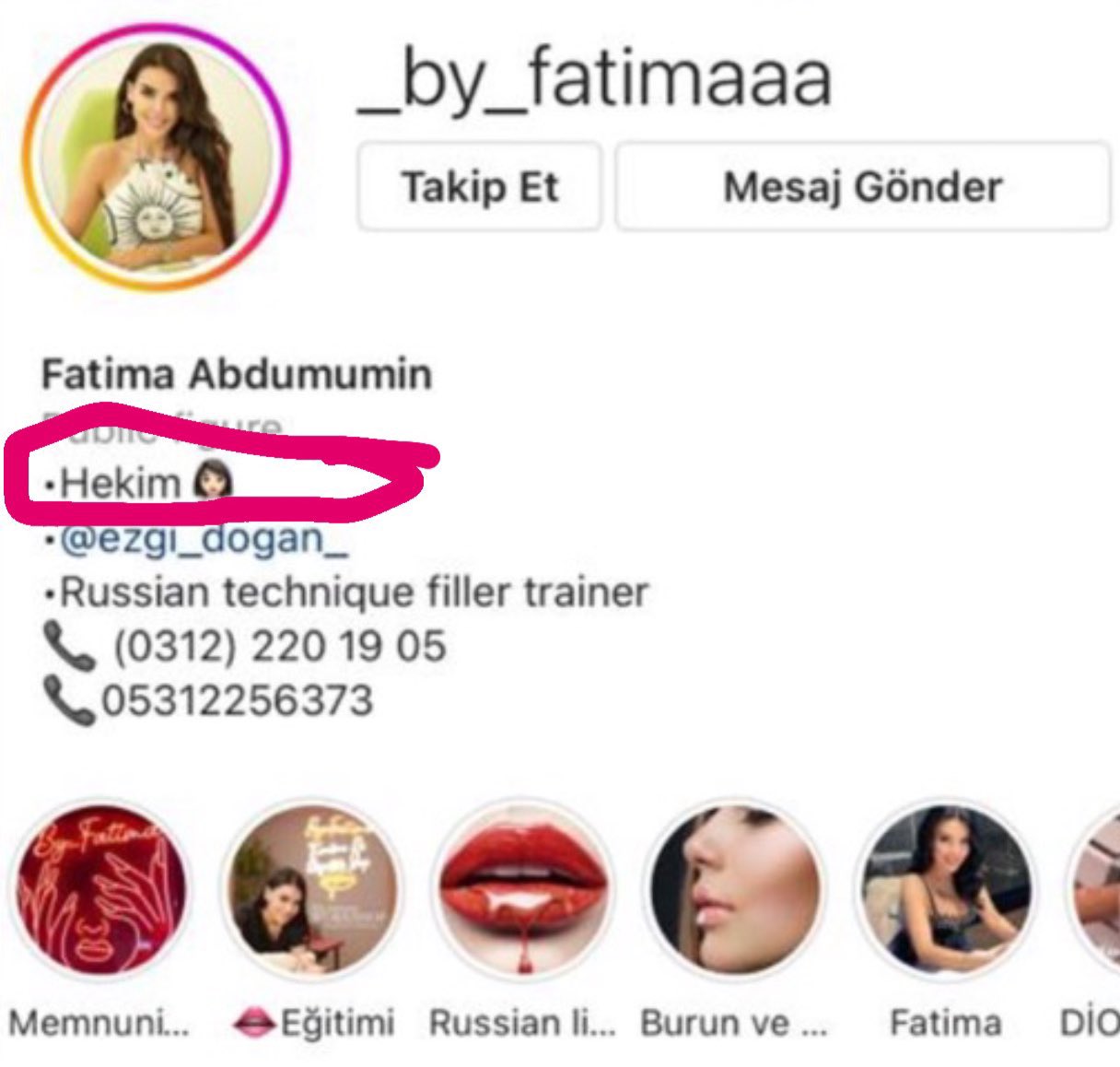 Fatima Azimoğlu Kimdir (7)