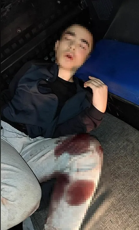 0X0 Son Dakika Izmirdeki Saldirida Yeni Detaylar 2 Tane Ses Bombasi Atti Babasini Biz Uyandirdik 1757320499078