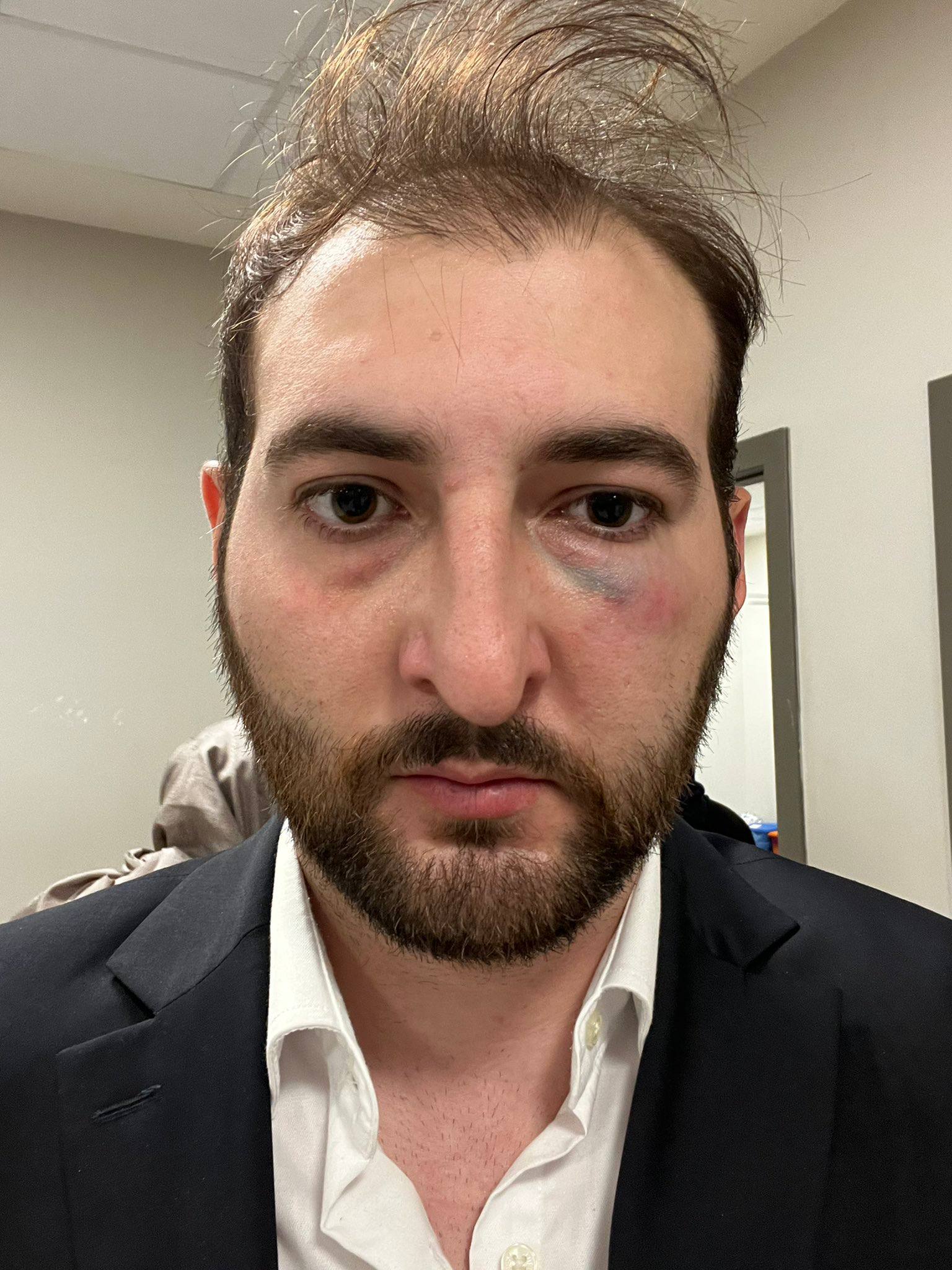 G5D6T Ow X E A A Qr Ti