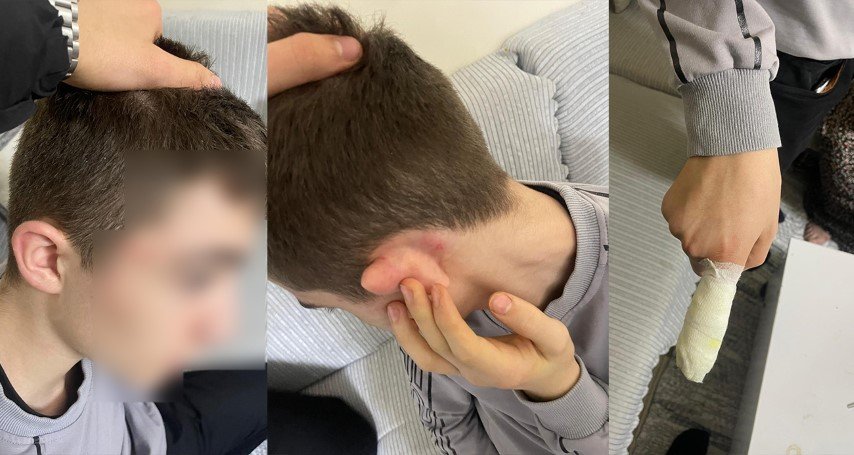 Ekmek almaya giden çocuğu hırsız sanıp tekme tokat dövdüler!