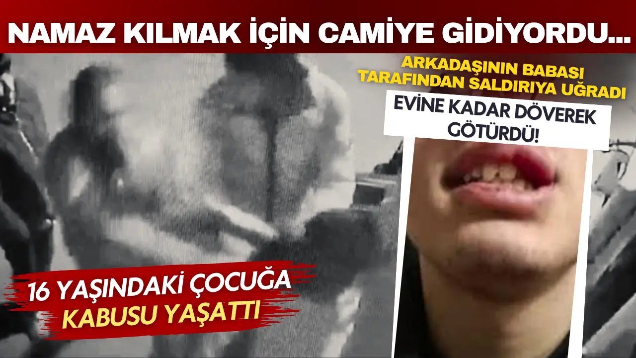 Namaz kılmak için camiye gidiyordu... Arkadaşının babası tarafından darp edildi!