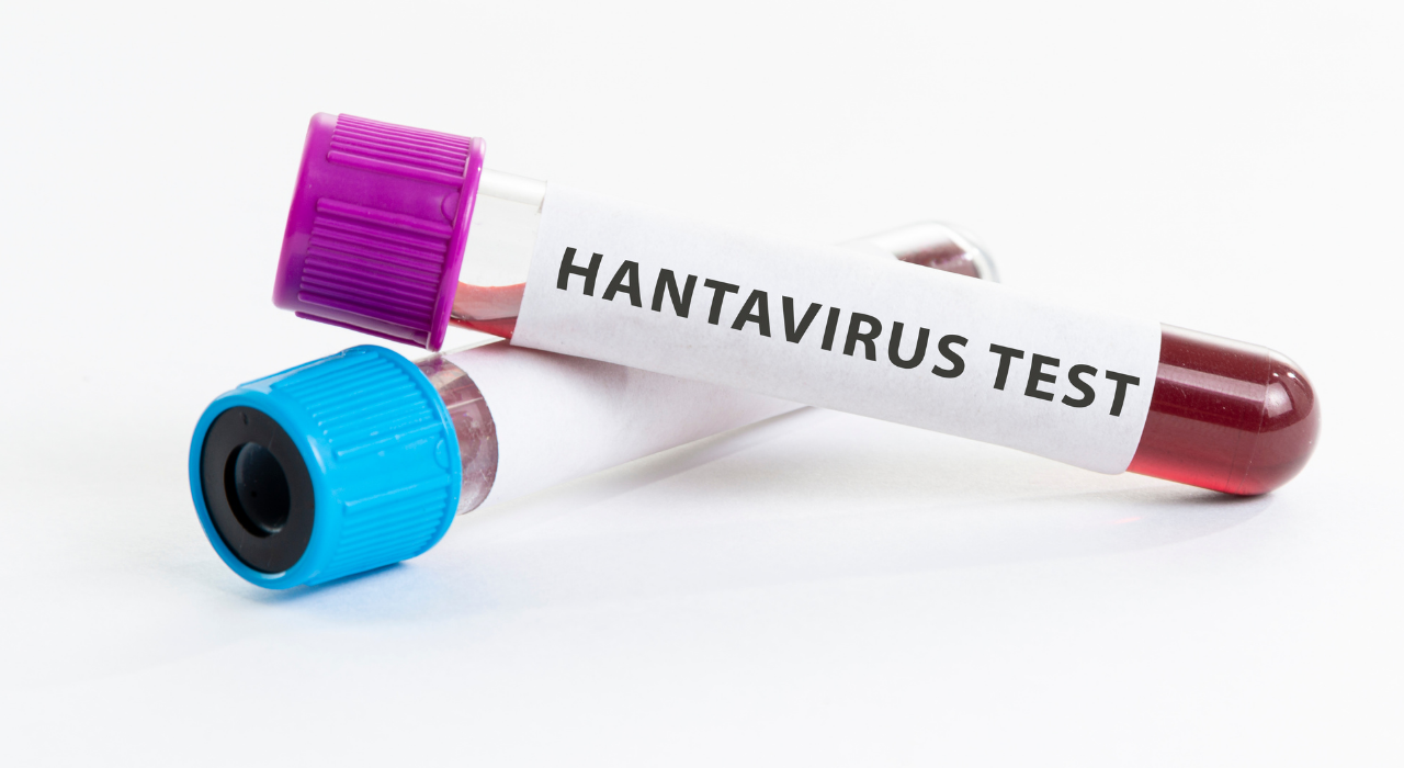 Hantavirüs (2)-1