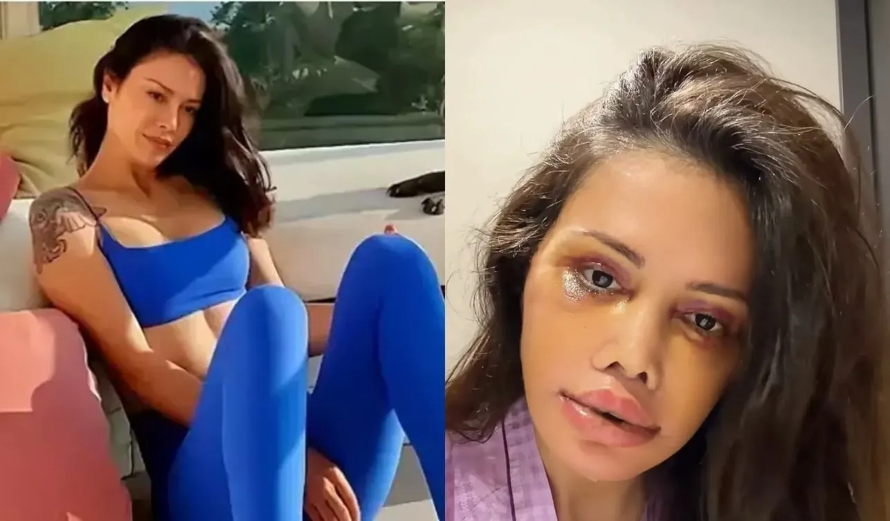 Didem Ceran Kimdir Neden Yuz Nakli Oldu Oryantal Star Evli Mi Esi Kim 1