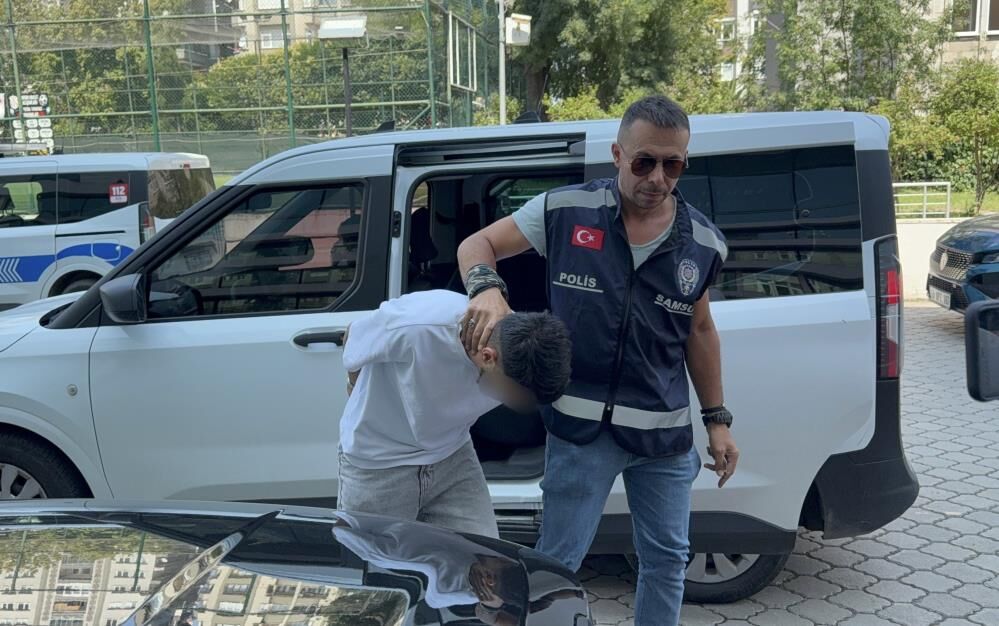Samsun'da kan donduran iddia! Kız arkadaşının kollarını kızgın kepçeyle yaktı
