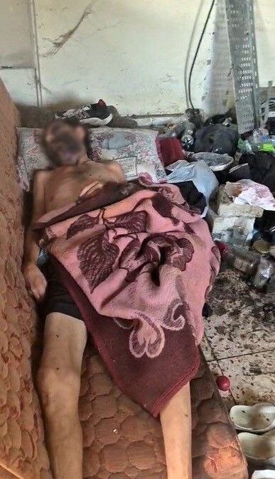 Önce Darp Edildi, Sonra Ölüme Terk Edildi! Günler Sonra Bulundu (2)