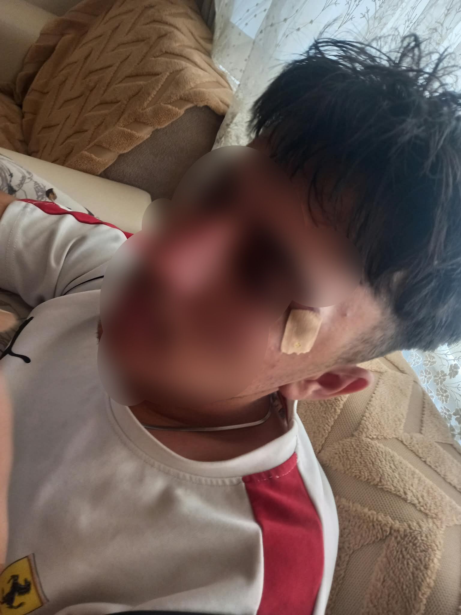 Afyonkarahisar’da öğretmenin öğrencisine kafa attığı iddia edildi: 16 yaşındaki çocuğun burnu kırıldı