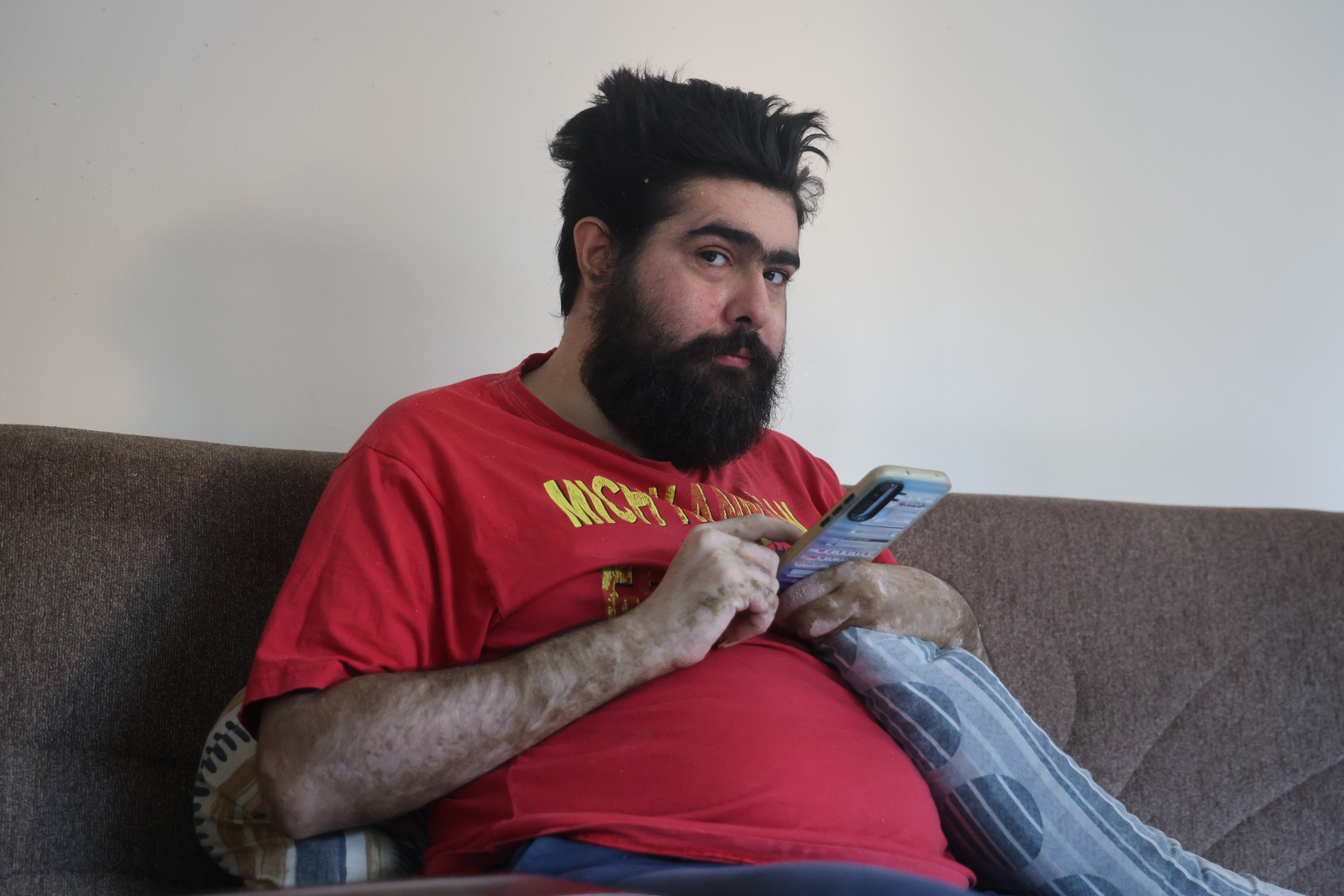“İstesem düzelirim ama istemiyorum” diyen Barış, telefon başındaki hayatına döndü