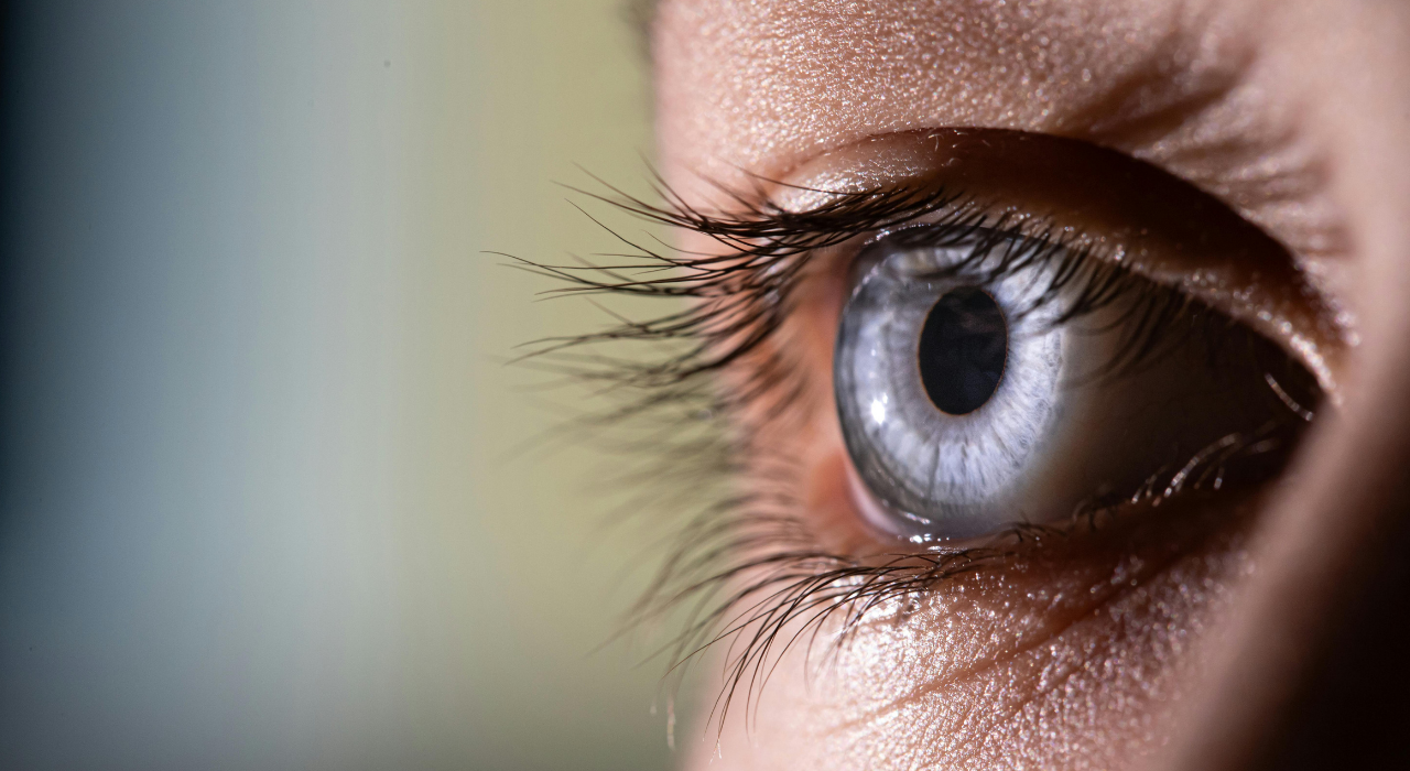 Diyabetik Retinopati (3)