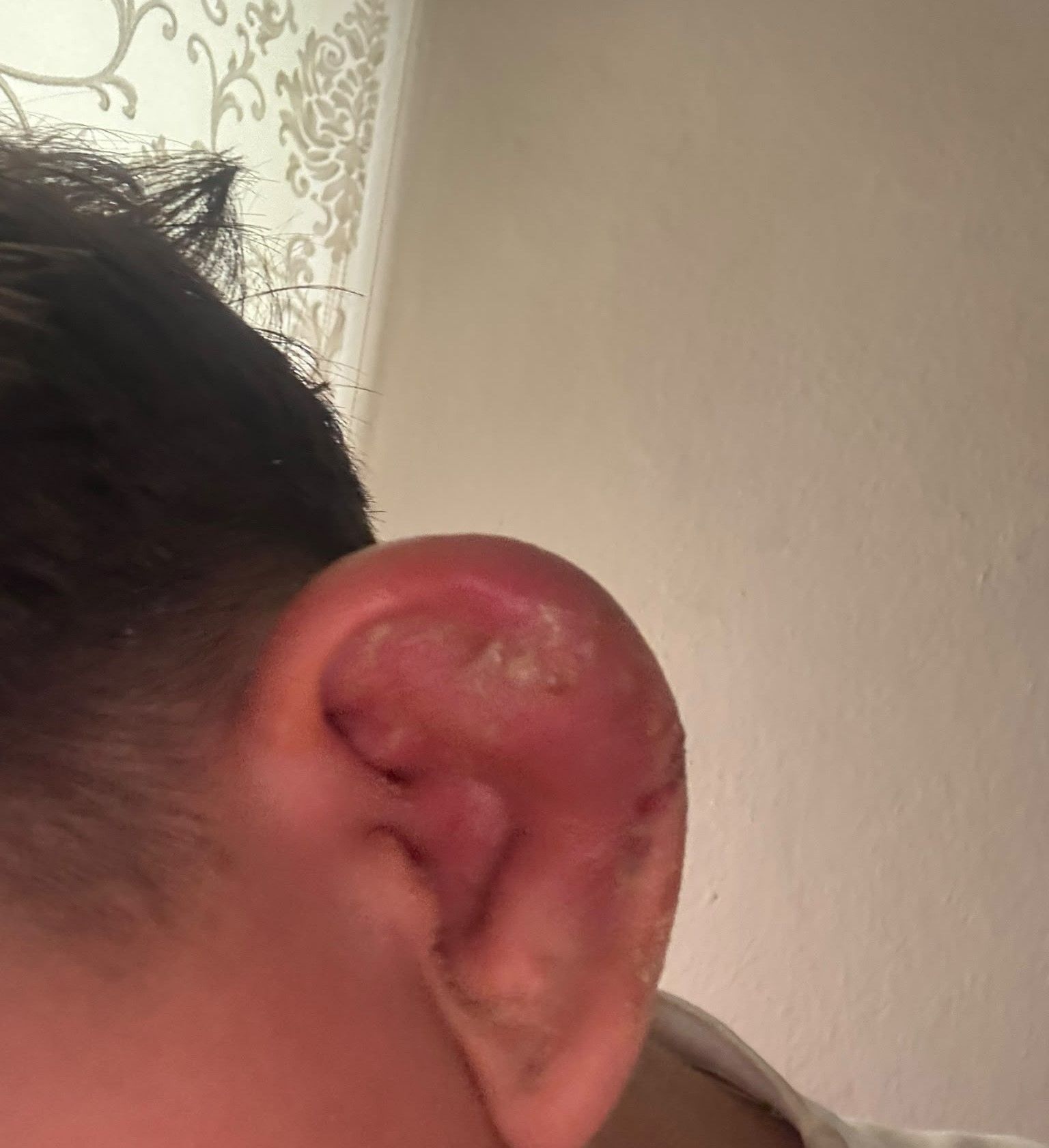 17 yaşındaki çocuğu hastanelik eden piercing olayında yeni gelişme! İşletmedeki denetimlerde dikkat çeken tespitler