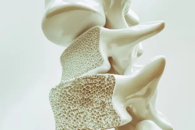 Kemiklerde sessiz kayıp: Osteoporoz ilk belirtisini kırıkla verebiliyor