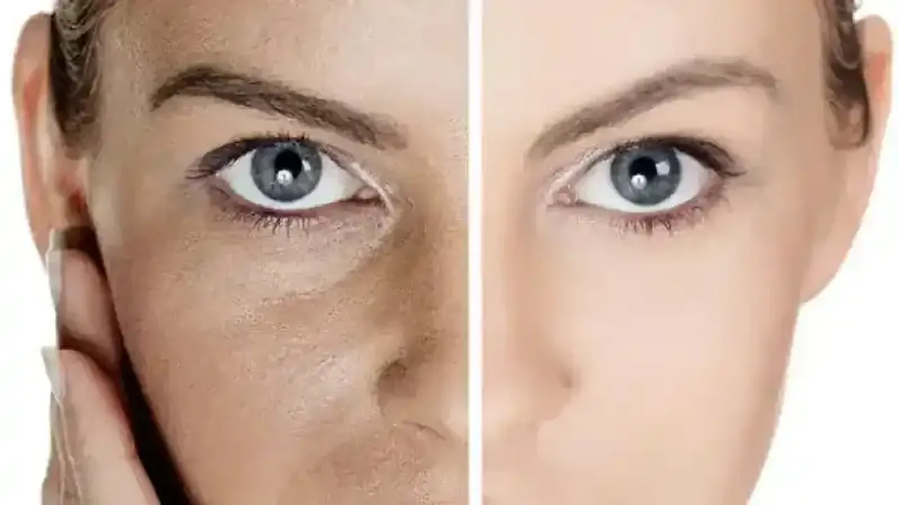 Cildinizin kusursuz olması imkansız değil: İşte havuç suyundan saunaya kadar Dünya'nın dört bir yanından kusursuz bir cilt için yapılan uygulamalar