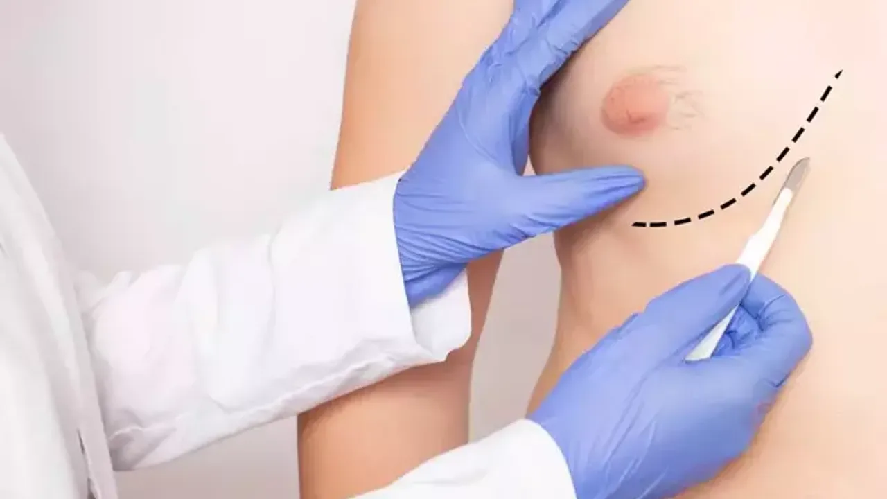 Erkeklerde obeziteye bağlı meme kanseri riski daha fazla! Uzmandan kritik uyarı