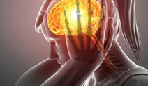 Türk bilim insanlarından çarpıcı migren bulgusu: Sorun yalnızca beyinde değil