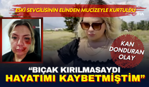 Eski sevgilisinin saldırısından mucizeyle kurtuldu: "Bıçak kırılmasaydı bugün ölmüştüm"