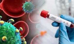 HIV ve AIDS’ten korunma yolları nelerdir? Uzmanında kritik uyarılar