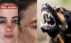 Çocuğu köpeklerin öldürdüğüne inanmayıp otopsi istemişti… Kendisi de köpek saldırısına uğradı!