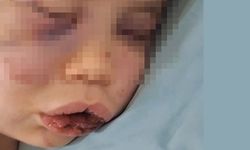 Kan donduran olay! 2 yaşındaki bebek annesinin sevgilisi tarafından darp edildi!