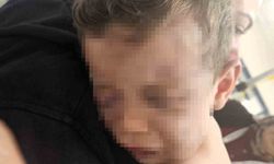 Aren bebeğe şiddet uygulayan anne ve erkek arkadaşı gözaltına alındı