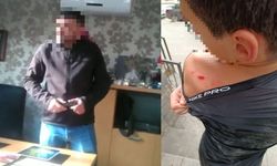 Ankara'da dehşet! 14 yaşındaki çocuk işletme çalışanı tarafından darp edildi!