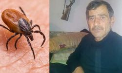 Kafasına yapışan keneyi elle çıkaran adam hayatını kaybetti!