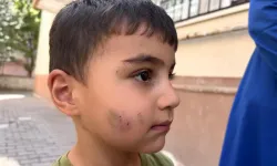 Ankara'da kabus gibi olay: Çocuğu uykusunda lağım faresi kemirdi!