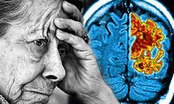 Ankara'da geliştirildi: Göz hareketleri ile Alzheimer teşhisi yapılabilecek!