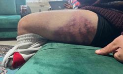 Vicdanları Yaralayan Saldırı: Otizmli Şahıs Odunla Darp Edildi