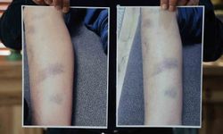 Diyarbakır’da Özel Okulda Darp İddiası: 8 Yaşındaki Çocuk İçin Suç Duyurusu