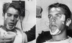 11 gün uyumazsak ne olur? Randy Gardner uykuzusluk deneyi sonrası bakın neler yaşadı