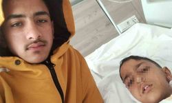 Ankara’da Sokak Köpeği Dehşeti: Okuldan Dönen Çocuk Yaralandı