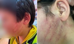 Konya’da ilkokulda dehşet: 8 yaşındaki çocukları veliler darbetti