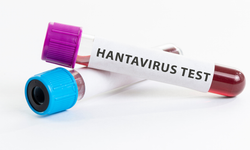 Uzmanından Hantavirüs uyarısı!