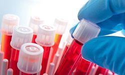 Laktat testi nedir? Neden yapılır?