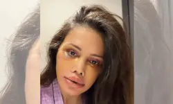 Didem Ceran Kimdir? Eşi kimdir? Oğlu kimdir? Neden yüz nakli yaptırdı?