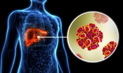 Neden herkes hepatiti ciddiye almalı? Prof. Dr. Karadurmuş anlattı