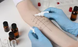 İmmünoterapi Nedir, Her Hastaya Uygulanır mı? Uzman Doktordan Merak Edilen Sorulara Yanıt