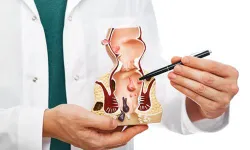 Çocuklarda hemoroid olur mu? Uzmanı yaş aralığına dikkat çekti