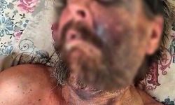 Önce darp edildi, sonra ölüme terk edildi! Günler sonra bulundu