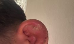 17 yaşındaki çocuğu hastanelik eden piercing olayında yeni gelişme! İşletmedeki denetimlerde dikkat çeken tespitler