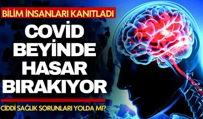 Bilim insanları kanıtladı: Covid beyinde hasar bırakıyor, tüm vücuda yayılıyor!