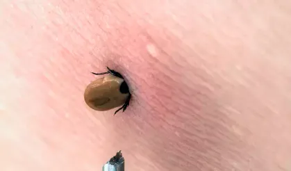 Kene En Çok Bu İllerde Görülüyor! Uzmanlardan Hayati Uyarılar