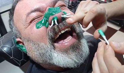 Burun kılına ağda yaptırdı, fenalaşarak yere yığıldı: Uzmanlardan kritik uyarı