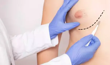 Erkeklerde obeziteye bağlı meme kanseri riski daha fazla! Uzmandan kritik uyarı