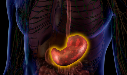 Erkeklerde daha fazla gözüküyor: İşte mide kanserinin nedenleri...