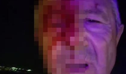Kocaeli’de görev başındaki muhabire saldırı: Yüzü kanlar içinde kaldı!