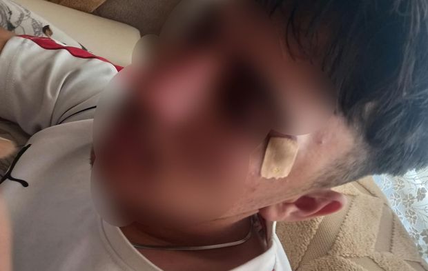 Afyonkarahisar’da öğretmenin öğrencisine kafa attığı iddia edildi: 16 yaşındaki çocuğun burnu kırıldı