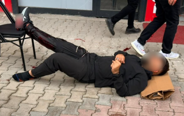 Adıyaman'da silahlı saldırı dehşeti: 32 yaşındaki kişi bacağından vuruldu!
