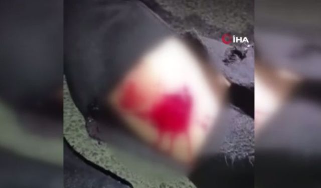 Sokakta yürüyen adam başıboş köpeklerin saldırısında yaralandı!