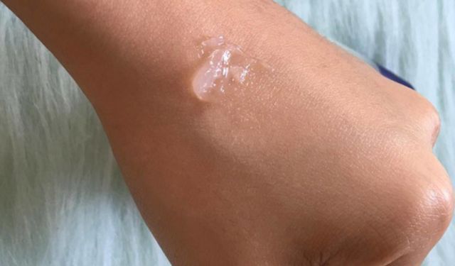 Stilex jel krem nedir ne işe yarar? Yüze sürülür mü? Fiyatı ne kadar?