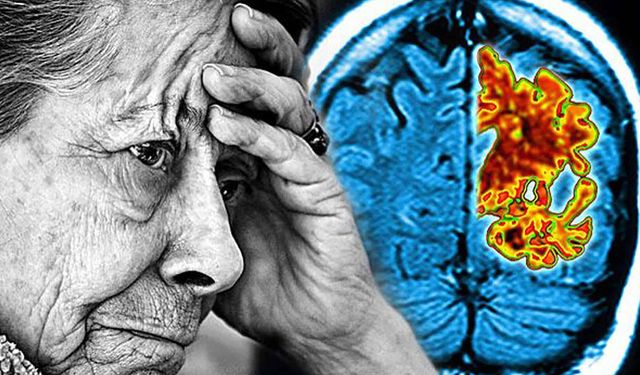 Ankara'da geliştirildi: Göz hareketleri ile Alzheimer teşhisi yapılabilecek!